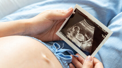 Ultrasound picture pregnant baby photo. Woman holding ultrasound pregnancy image. Concept of...