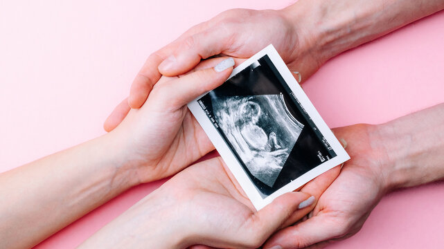 Ultrasound picture pregnant baby photo. Woman hands holding ultrasound pregnancy image on pink background. Concept of pregnancy, maternity, expectation for baby birth.