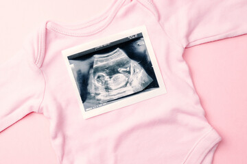 Ultrasound picture pregnant baby photo. Fashion cute baby cloth with ultrasound pregnancy image on...