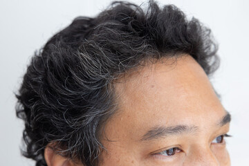 Young Asian Man with Premature Grey Hair Pronblem