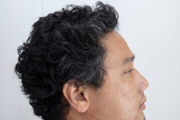 Fototapeta premium Young Asian Man with Premature Grey Hair Pronblem