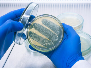 Close-up, a scientist opened a petri dish and examines the bacteria inside, working in the...