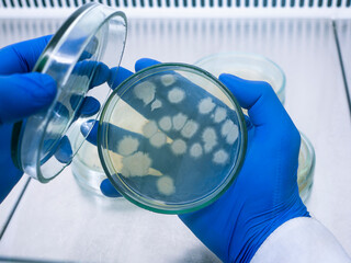 The scientist opened a petri dish with large colonies of bacteria, the researcher works in the...