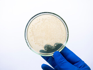 Close-up, the hand of a scientist in a blue glove holds a petri dish with small colonies of...