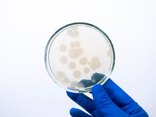 Close-up, the hand of a scientist in a blue glove holds a Petri dish with large colonies of...