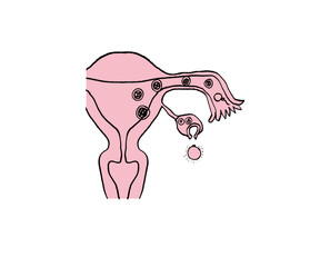 受精までの課程　子宮　精子　卵子　受精卵　医療