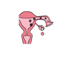 受精までの課程　子宮　精子　卵子　受精卵　医療