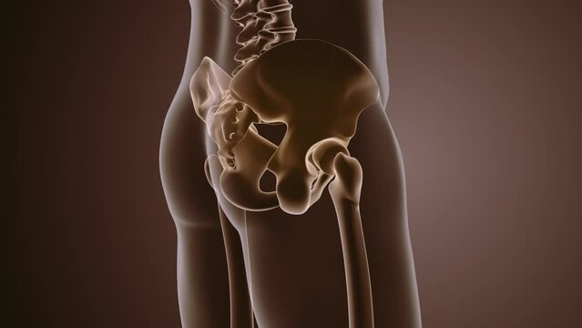 Animation of a painful pelvic girdle