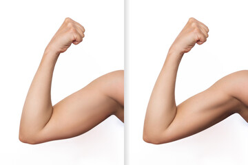 Two shots of a young woman with excess fat on her arm and toned arm before and after losing weight...