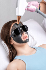 Carbon peeling procedure to beautiful blue-eyed girl in a beauty salon. Hardware cosmetology...