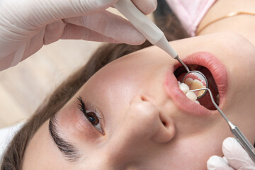 Dentist examining patient teeth with dental mirror during dental check up