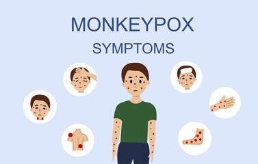 Monkeypox virus symptoms illustration with male character.
Monkeypox outbreak concept by world health organization with
examples and explanation.