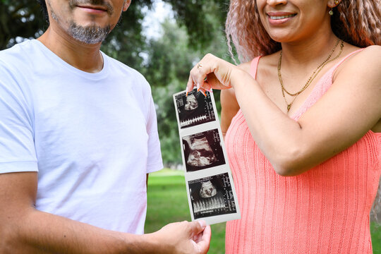 Couple holding ultrasound outdoor and announcing pregnancy