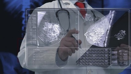 Breast Cancer analysis - Powered by Adobe