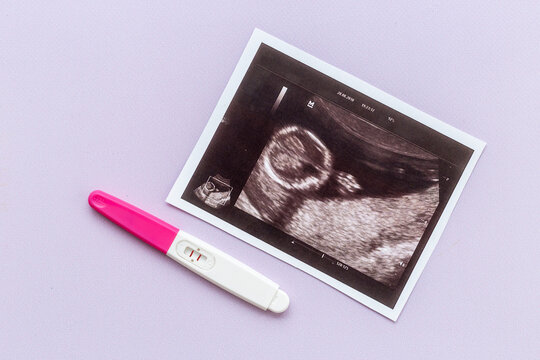 Ultrasound picture of unborn baby with positive pregnancy test