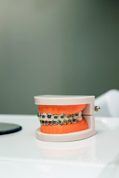 A model of the jaw with braces lies on the table at the orthodontist