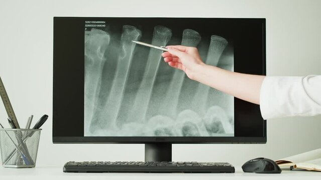 Doctor veterinarian examining skeleton roentgen on computer monitor. Woman vet analyzing animal bones x-ray, ribs close-up. Healthcare and medicine concept. 
