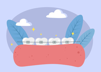 Teeth with dental braces flat composition vector illustration