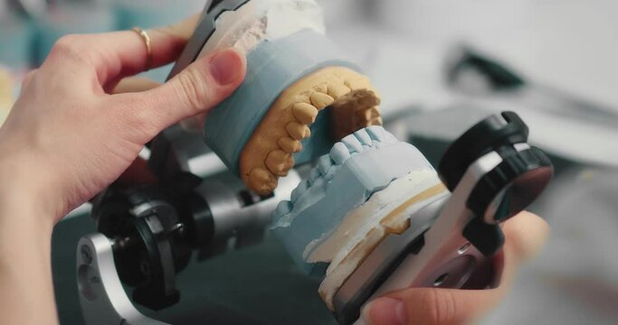 Dental technician makes a plaster cast of jaw models in an articulator. Production of a dental implant in a dental laboratory