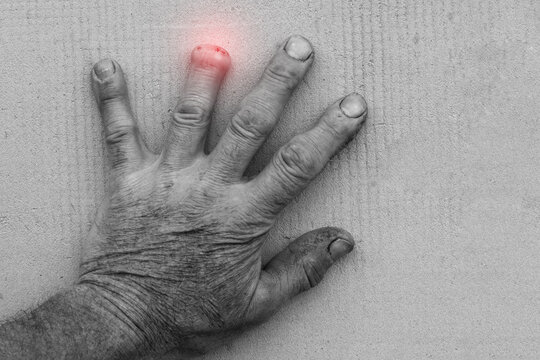 Male turner with professional injury - amputation of part of the finger, close-up male hand from dangerous work