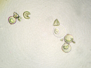 杉の花粉3（400倍）の顕微鏡写真