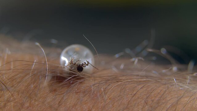 A tick parasite on the skin of a person or animal tries to roll over. Parasites carrying encephalitis and Lyme disease. Sting, trunk and paws close-up.