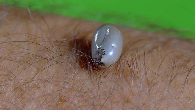 tick, encephalitis, lyme, parasite, human, sting, dangerous, mite, contact, leather, hair, bite, predator, infection, danger, monster, acariformes, arachnid, biology, blood, bloodsucking, borreliosis,