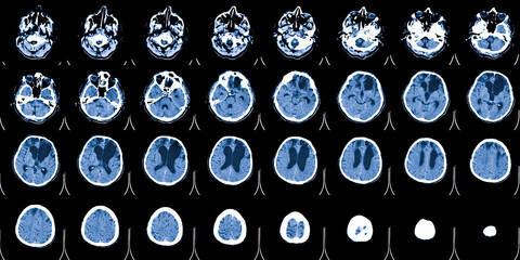 MRI scan of the brain. Magnetic resonance imaging scan. Medicine, science and education CT...