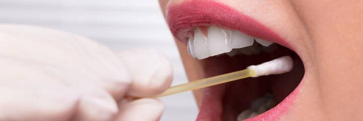 Dentist's Hand Taking Saliva Test From Woman's Mouth
