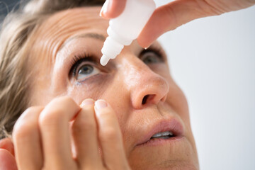 Young Woman Putting Eye Drops In Her Eyes