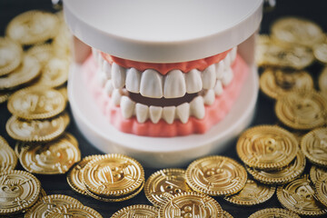 歯列模型とお金