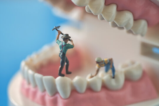 歯型模型と治療イメージ