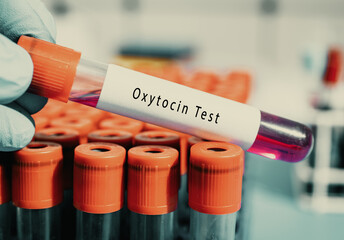 Pituitary gland Oxytocin hormone Test Stimulates contraction of uterus and milk ducts in the breast...