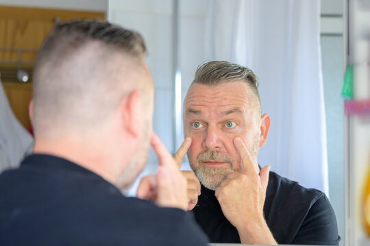 Dismayed Middle-aged Man Looking At Bags Under His Eyes