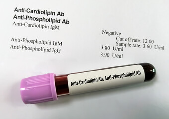 Anti-Cardiolipin Ab and Anti-Phospholipid Ab test, autoimmune disorder diagnosis.