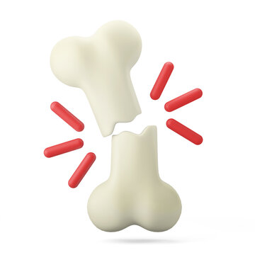 medical orthopedic fractured painful injured broken bone skeletal abstract concept 3d illustration 3d icon isolated