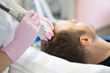Obraz na płótnie Canvas Doctor female dermatologist trichologist makes a procedure to stimulate hair growth to a patient man. Laser treatment of alopecia and hair loss