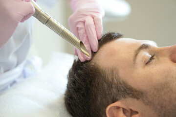 Doctor female dermatologist trichologist makes a procedure to stimulate hair growth to a patient...