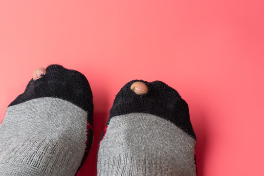 Broken sock with a hole.