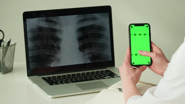 Healthcare and medicine. Doctor using phone with green chroma key screen, examining lungs x-ray on laptop close-up. Therapist checking roentgen, human chest, checkup. 