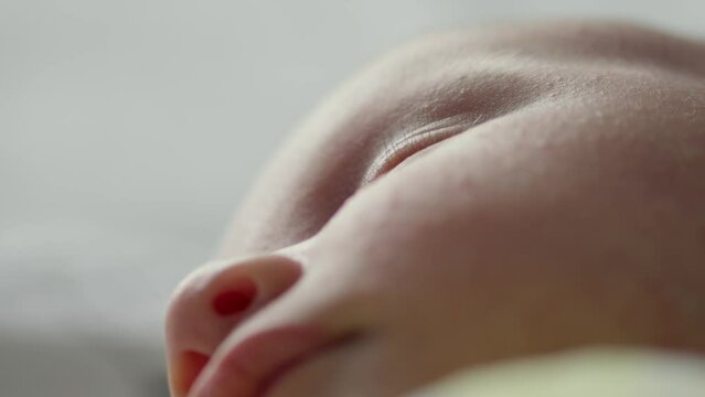  Macro shot of a sleeping childs face affected by diathesis. Troubled face skin of a small caucasian baby.   Cinematic footage of childs face with skin defect. Closeup footage of babies cheecks. 