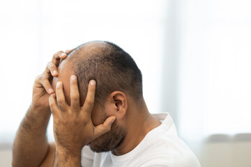 Close up man hair loss. Young man itchy head There is a fungus on the scalp dandruff red rash be scratched head to bring relief. Need to consult a doctor. Hair problems hair loss.