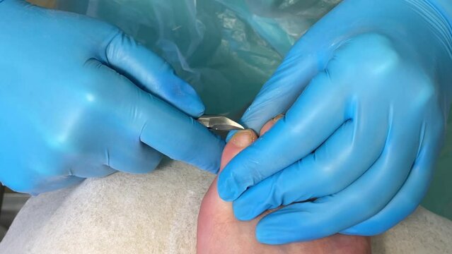 Foot and nail care. The process of a professional pedicure. Master in blue gloves processes the nail plate with a metal tool, pedicure in a beauty salon