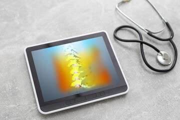 digital tablet with x-ray of spine skeleton. Red pain on the bones.