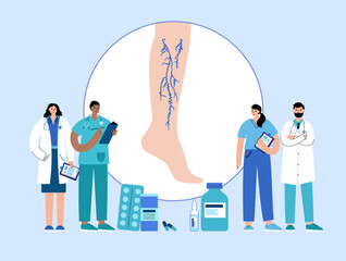 Varicose veins treatment