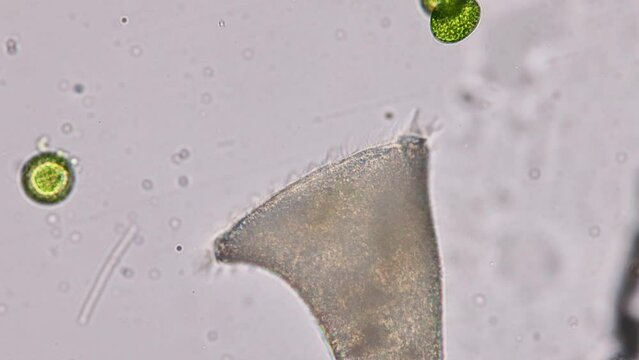 Stentor, sometimes called trumpet animalcules, are a genus of filter-feeding, heterotrophic ciliates, representative of the heterotrichs in waste water
