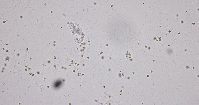 Bacteria and Protozoa in waste water under the microscope.