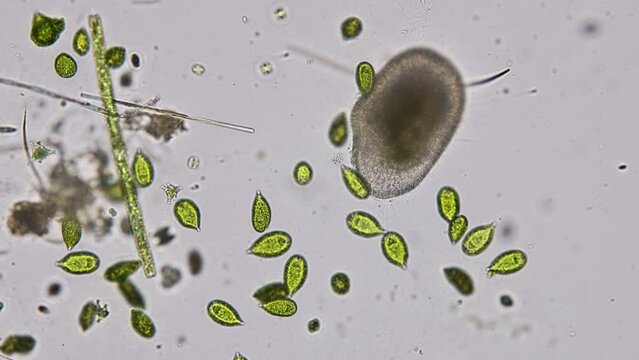 Bacteria and Protozoa in waste water under the microscope.