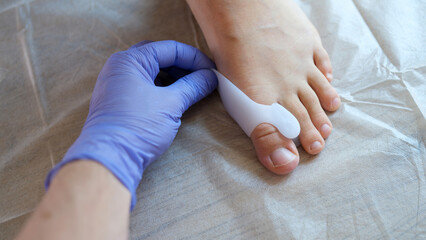 Doctor orthopedist applying brace for hallux valgus