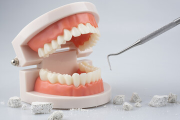 Teeth model with dental plaque tool ,Concept Dental care cleaning bacterial plaque and scaling...